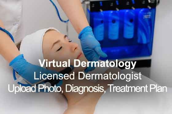Virtual Dermatology Licensed Dermatologist Upload Photo, Diagnosis, Treatment Plan